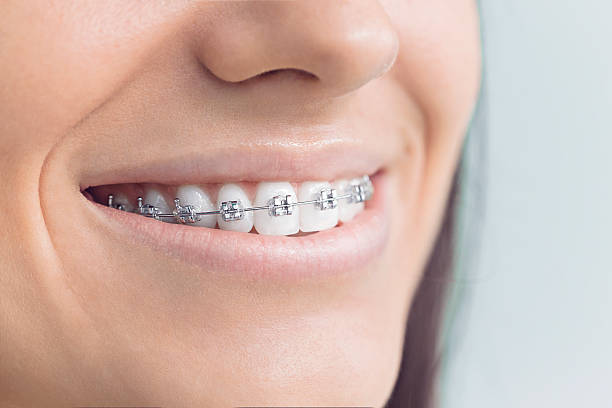 Best Root Canal Treatment  in Wenona, IL